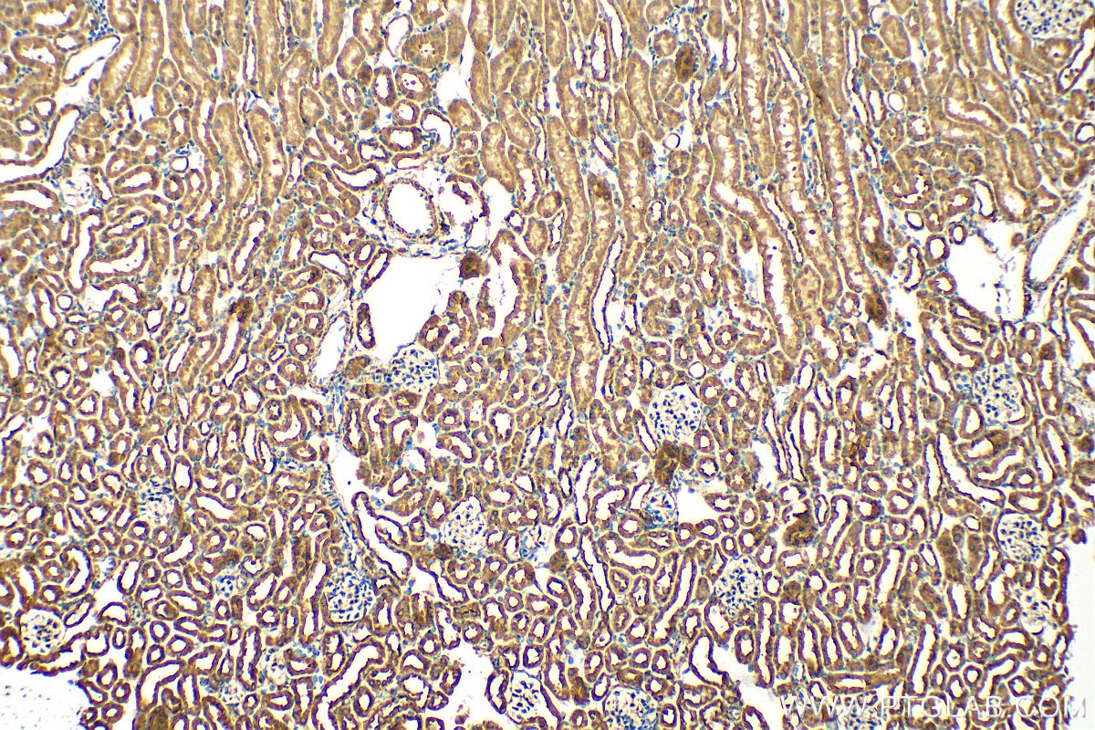 Immunohistochemistry (IHC) staining of mouse kidney tissue using ATG3 Polyclonal antibody (11262-2-AP)