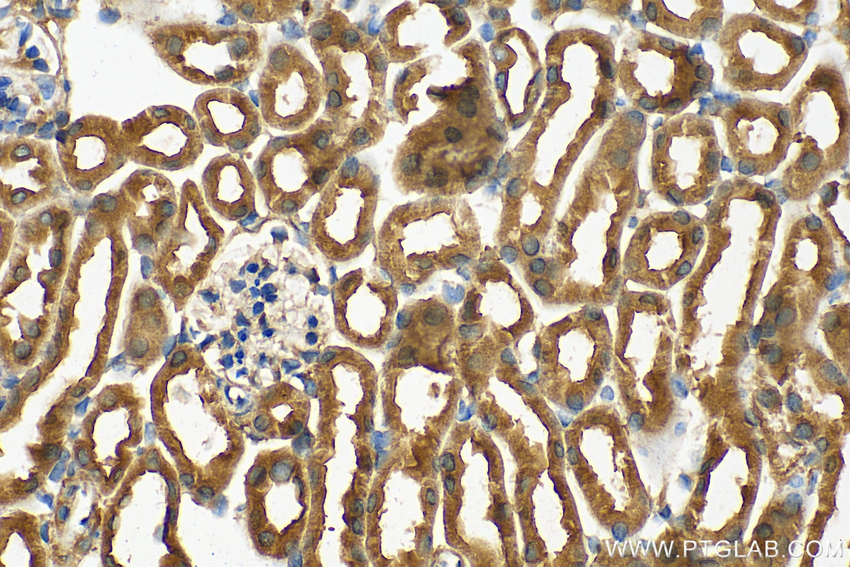 IHC staining of mouse kidney using 11262-2-AP