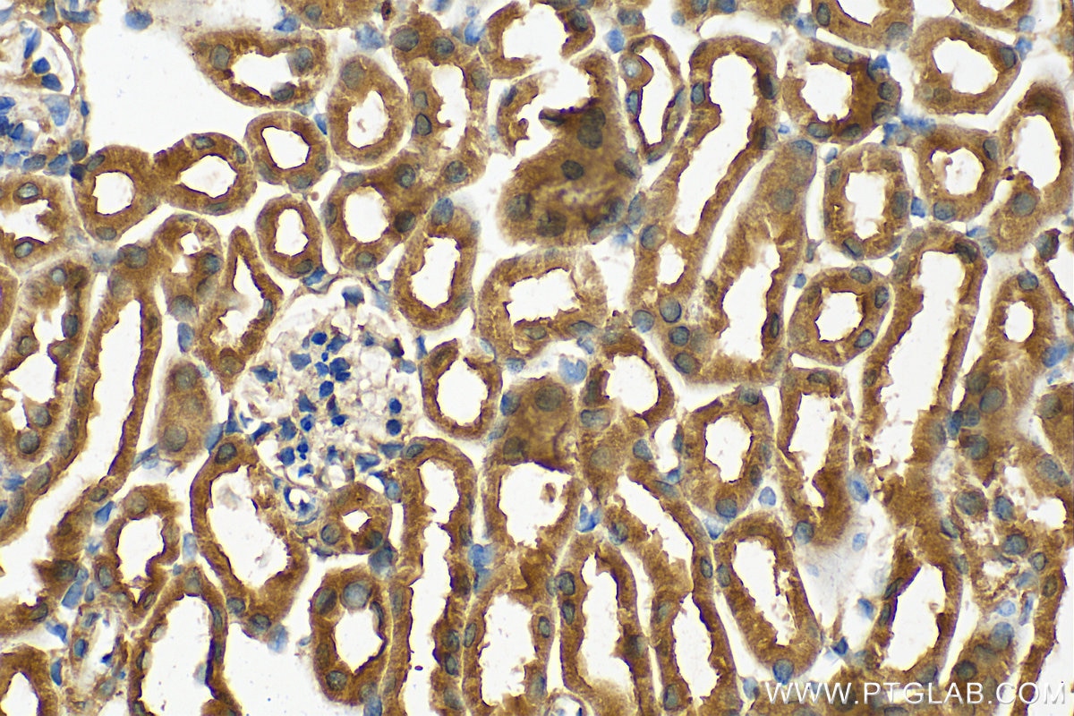 Immunohistochemistry (IHC) staining of mouse kidney tissue using ATG3 Polyclonal antibody (11262-2-AP)