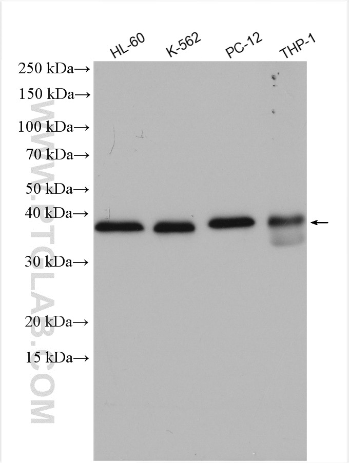 Western Blot (WB) analysis of various lysates using ATG3 Polyclonal antibody (11262-2-AP)