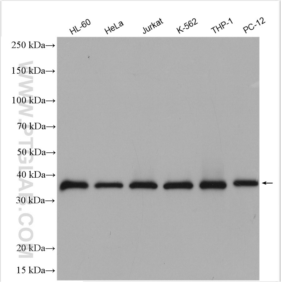 WB analysis using 11262-2-AP