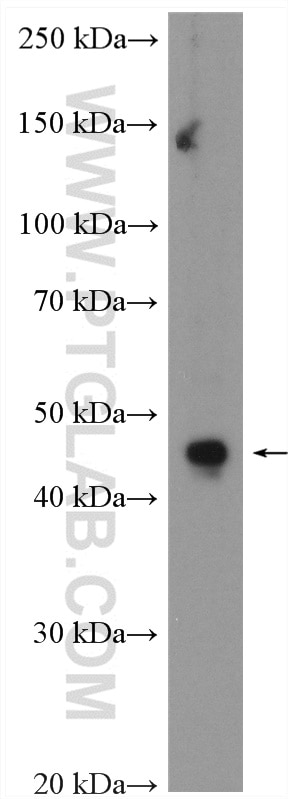 WB analysis of MKN-45 using 27467-1-AP