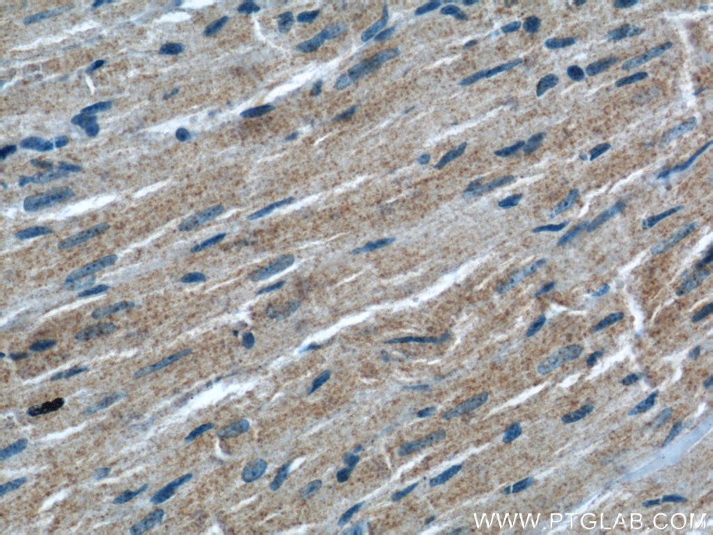 Immunohistochemistry (IHC) staining of mouse heart tissue using ATG4B Polyclonal antibody (15131-1-AP)