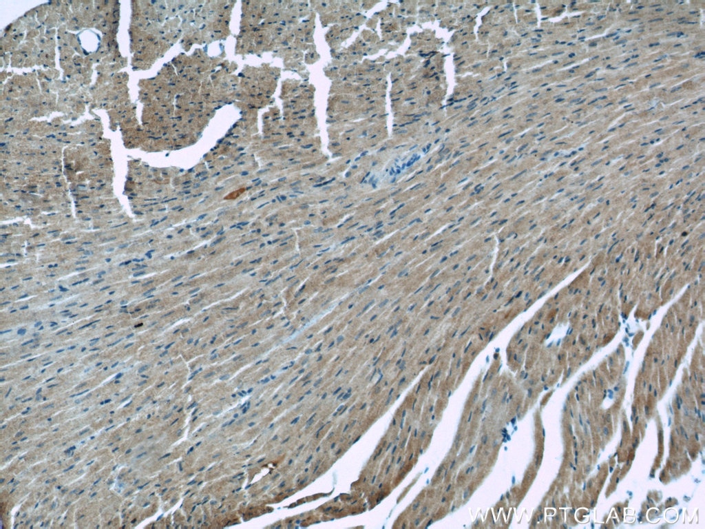 IHC staining of mouse heart using 15131-1-AP