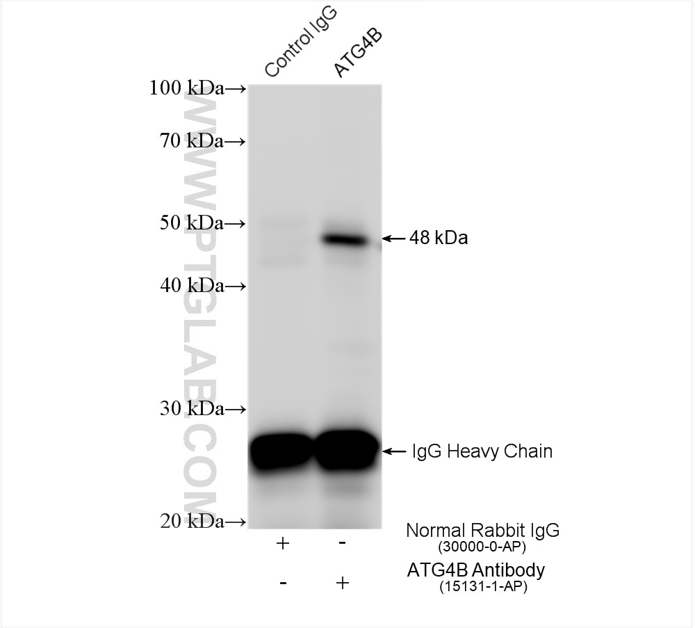 Immunoprecipitation (IP) experiment of HeLa cells using ATG4B Polyclonal antibody (15131-1-AP)