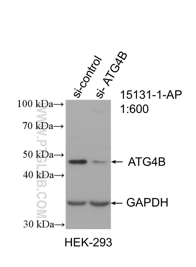 Western Blot (WB) analysis of HEK-293 cells using ATG4B Polyclonal antibody (15131-1-AP)