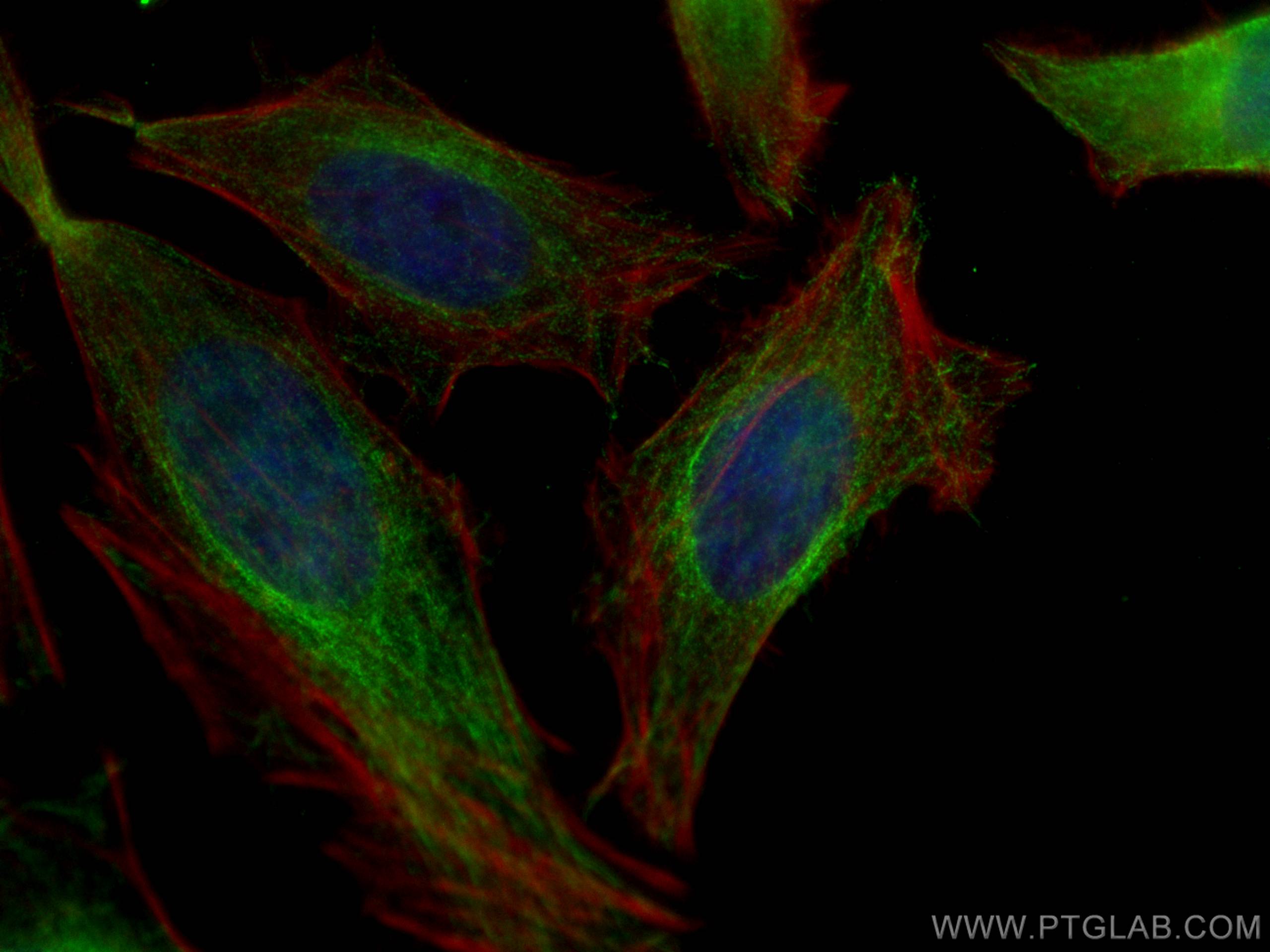 Immunofluorescence (IF) / fluorescent staining of HeLa cells using ATG4B Monoclonal antibody (67727-1-Ig)