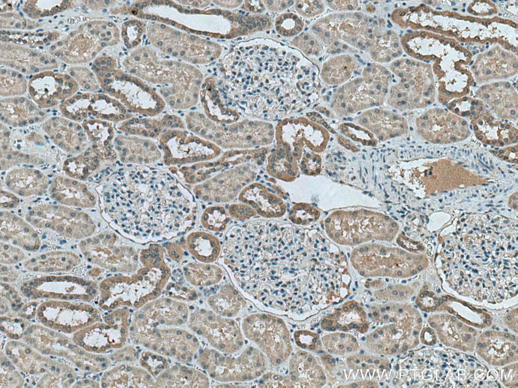 IHC staining of human kidney using 67727-1-Ig