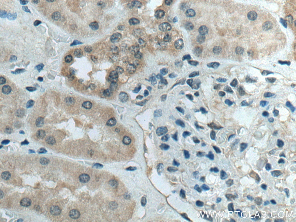 Immunohistochemistry (IHC) staining of human kidney tissue using ATG4B Monoclonal antibody (67727-1-Ig)