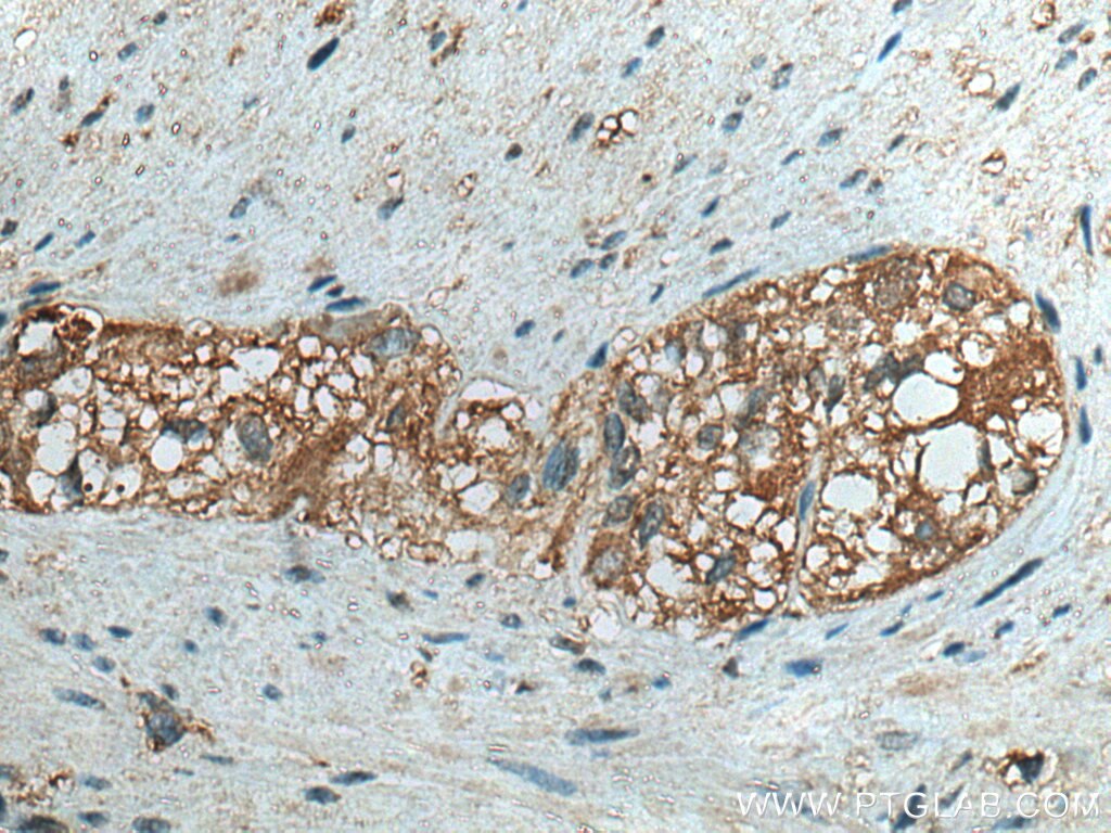 Immunohistochemistry (IHC) staining of human colon tissue using ATG4B Monoclonal antibody (67727-1-Ig)