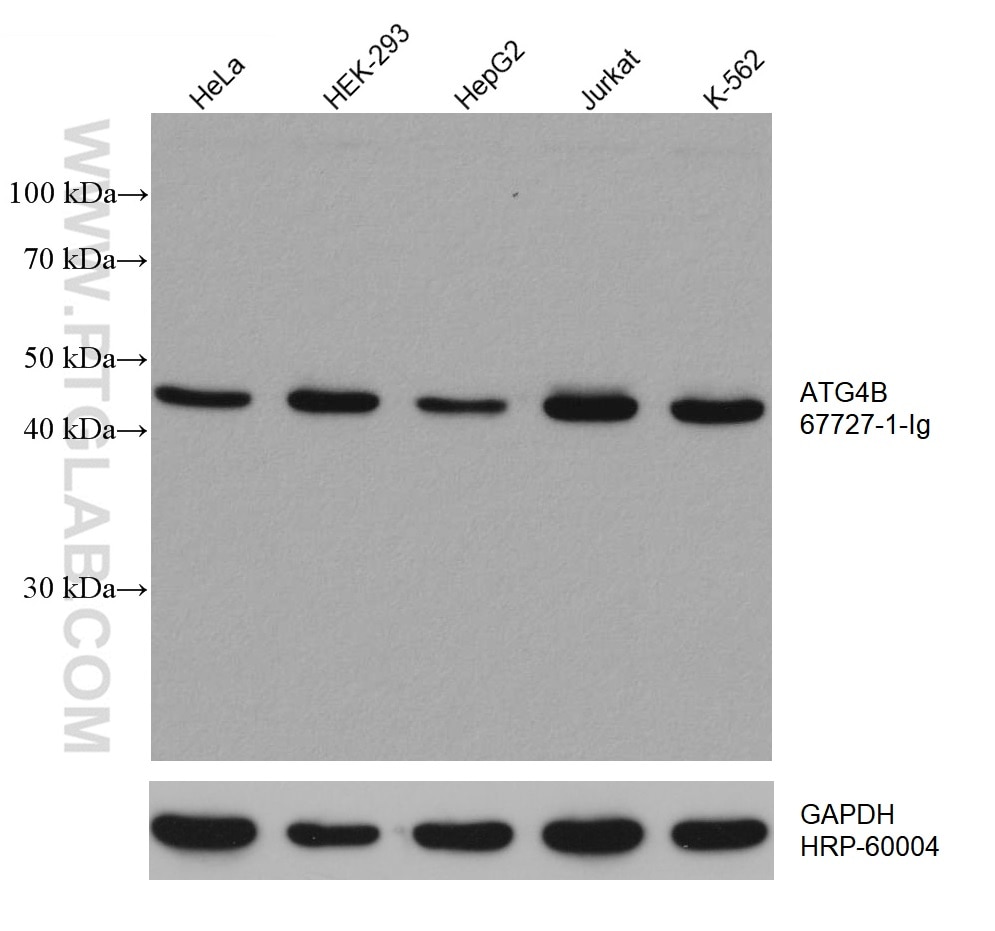 Western Blot (WB) analysis of various lysates using ATG4B Monoclonal antibody (67727-1-Ig)
