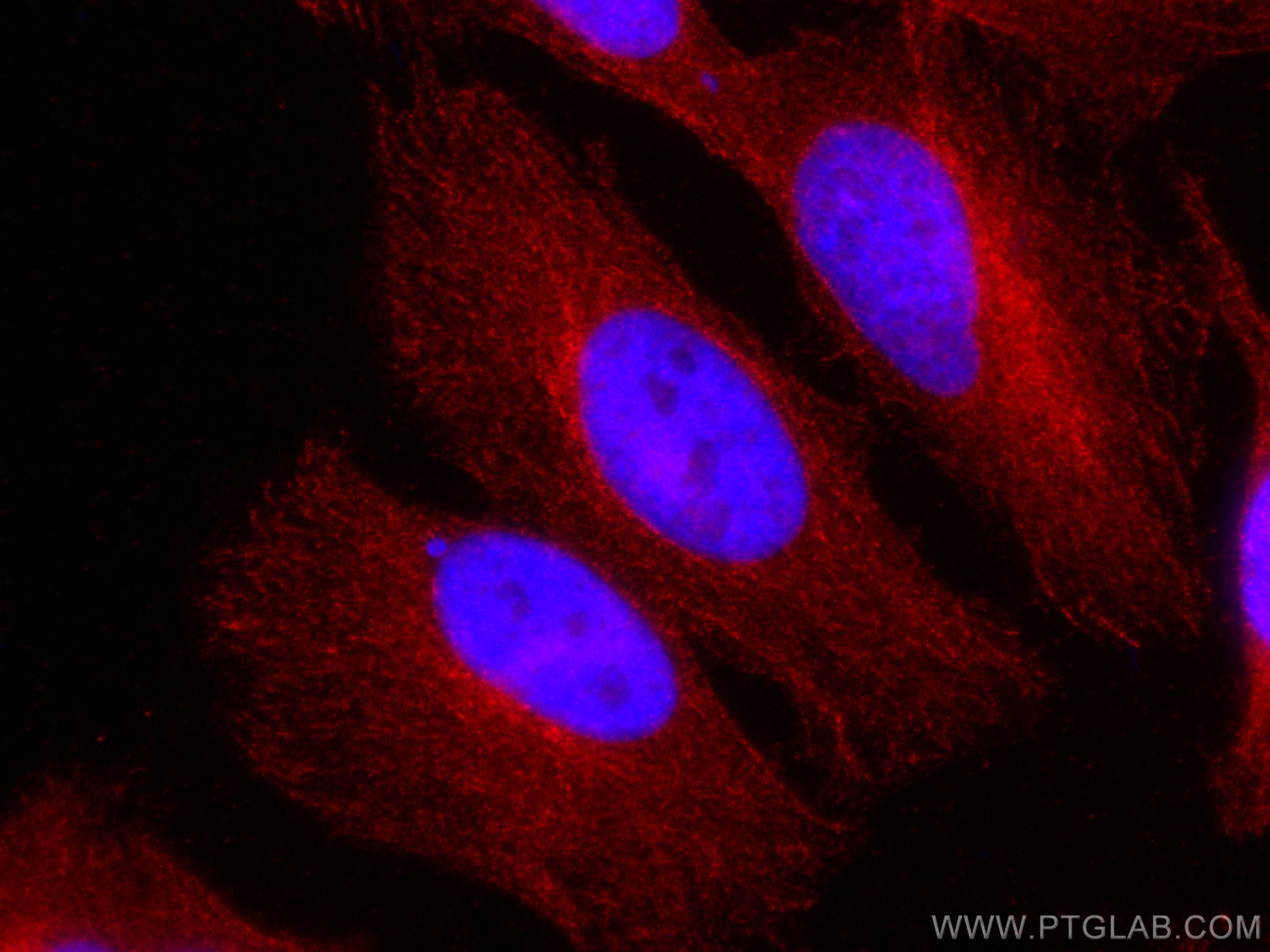 Immunofluorescence (IF) / fluorescent staining of HeLa cells using CoraLite®594-conjugated ATG4B Monoclonal antibody (CL594-67727)
