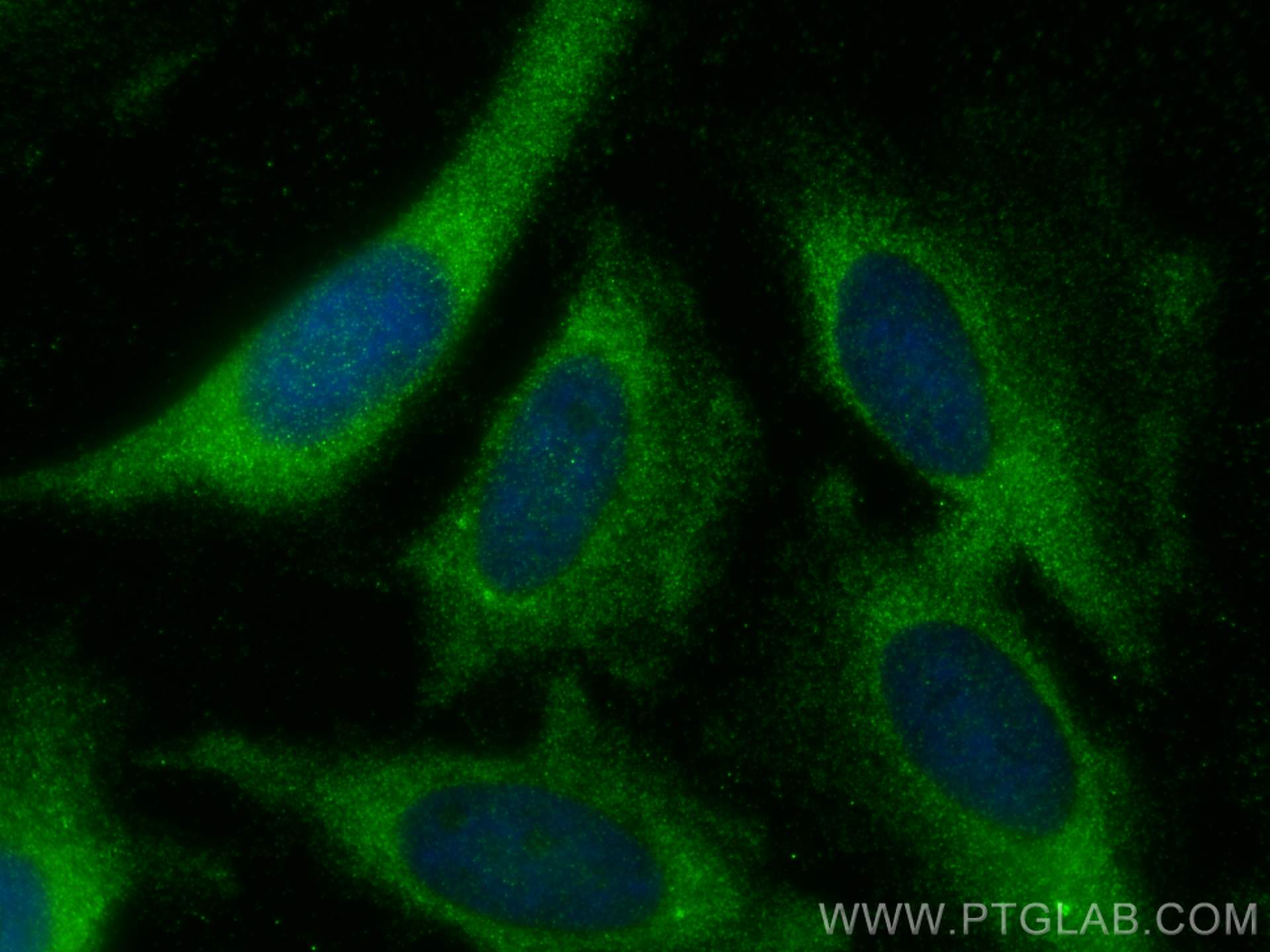 Immunofluorescence (IF) / fluorescent staining of HeLa cells using ATG4C Polyclonal antibody (20382-1-AP)