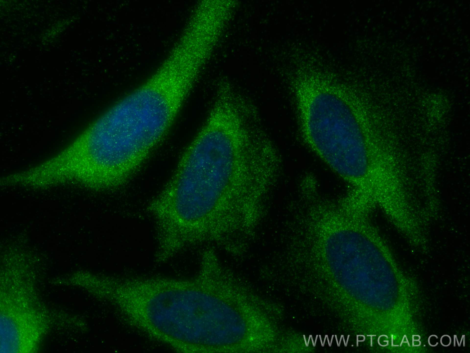 Immunofluorescence (IF) / fluorescent staining of HeLa cells using ATG4C Polyclonal antibody (20382-1-AP)