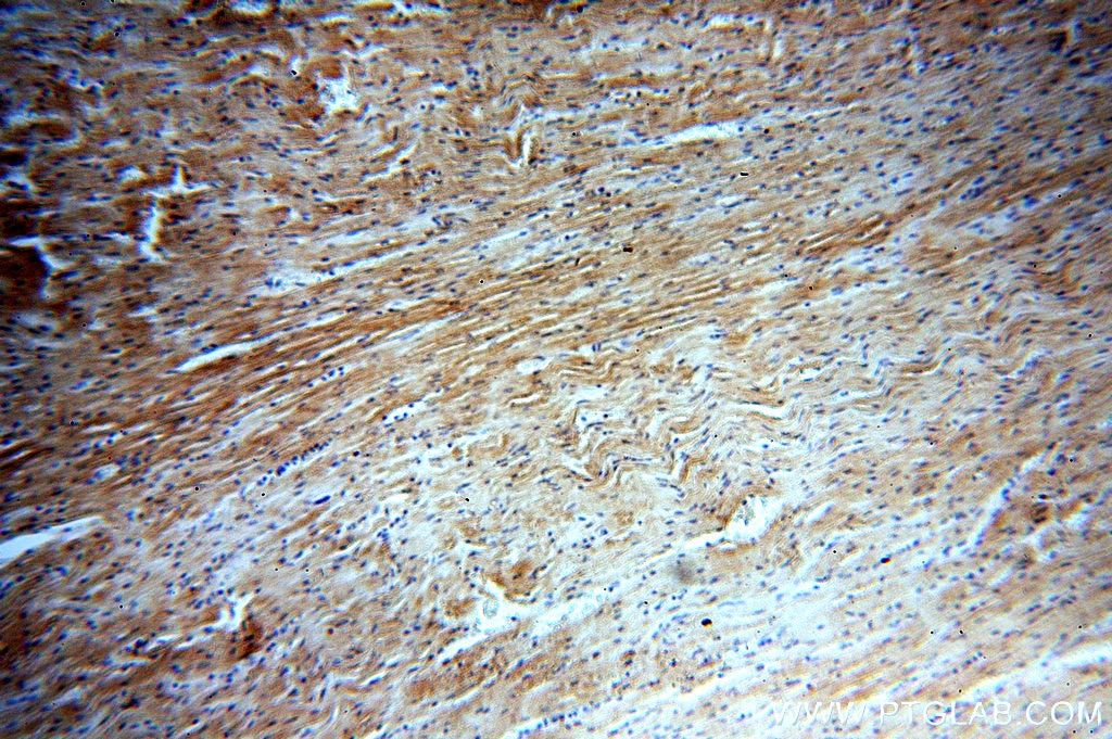 Immunohistochemistry (IHC) staining of human heart tissue using ATG4C Polyclonal antibody (20382-1-AP)