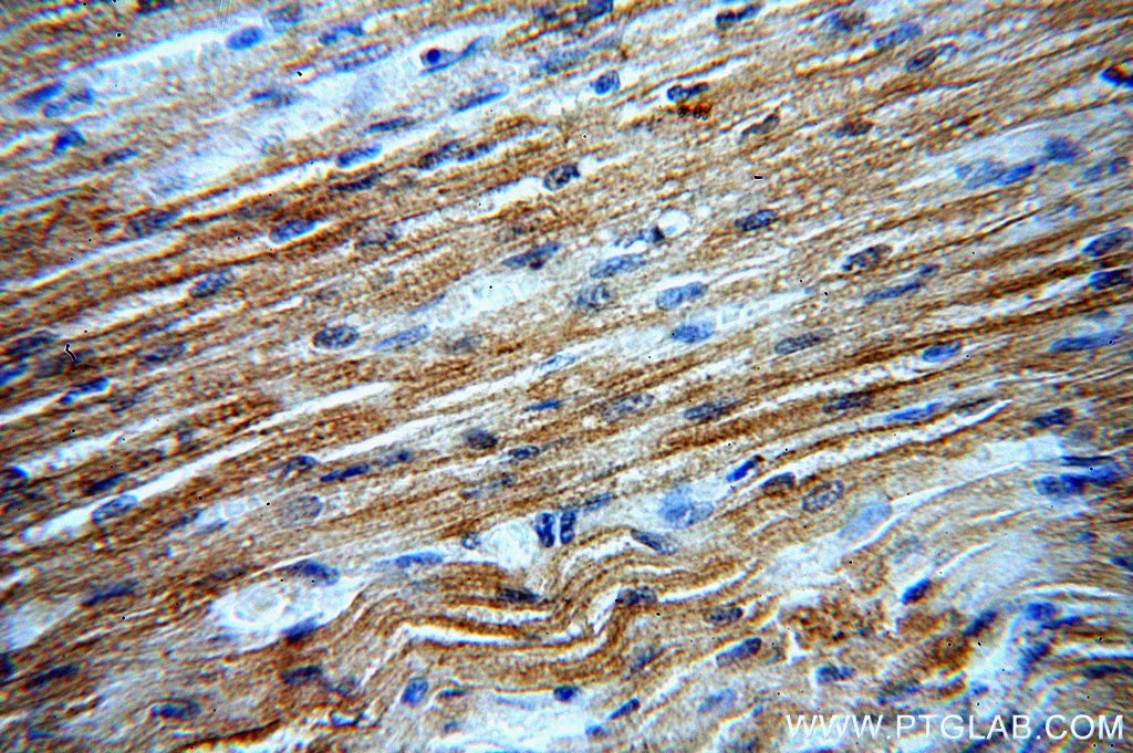 Immunohistochemistry (IHC) staining of human heart tissue using ATG4C Polyclonal antibody (20382-1-AP)