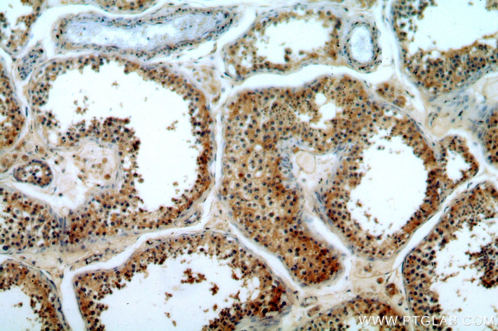Immunohistochemistry (IHC) staining of human testis tissue using ATG4C Polyclonal antibody (20382-1-AP)