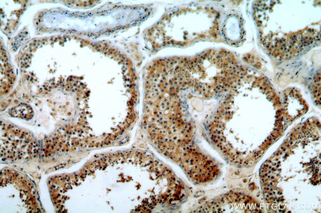 IHC staining of human testis using 20382-1-AP