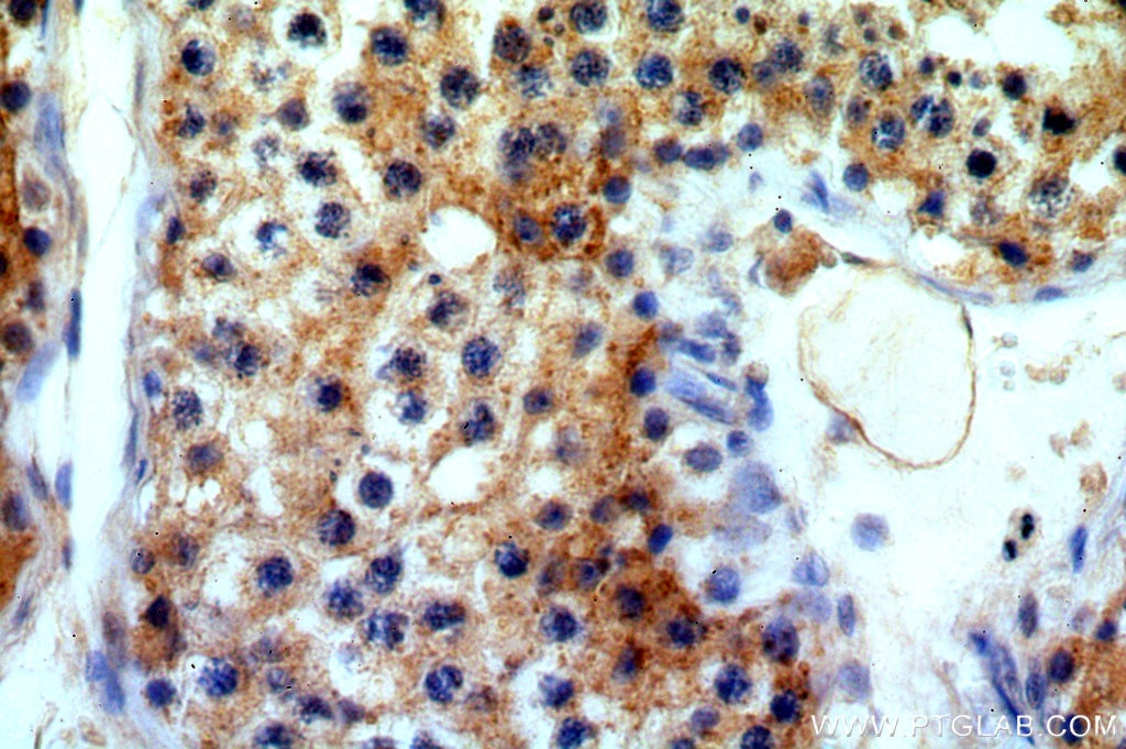 IHC staining of human testis using 20382-1-AP