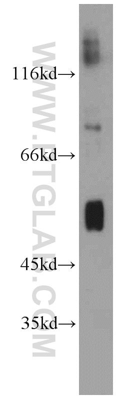 Western Blot (WB) analysis of human brain tissue using ATG4D Polyclonal antibody (16924-1-AP)