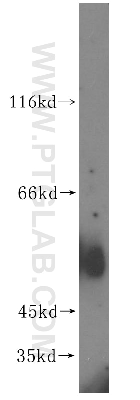 Western Blot (WB) analysis of human brain tissue using ATG4D Polyclonal antibody (16924-1-AP)