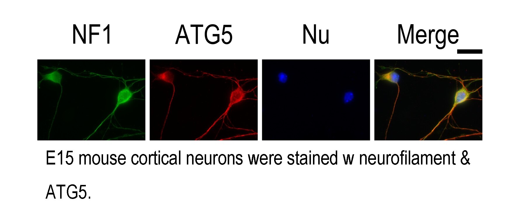 ATG5 Polyclonal antibody