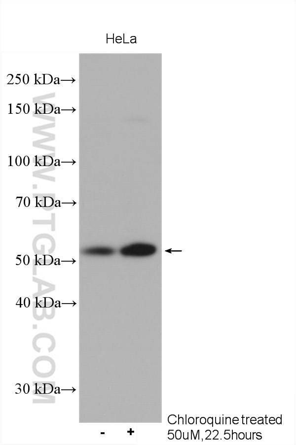 Western Blot (WB) analysis of various lysates using ATG5 Polyclonal antibody (10181-2-AP)