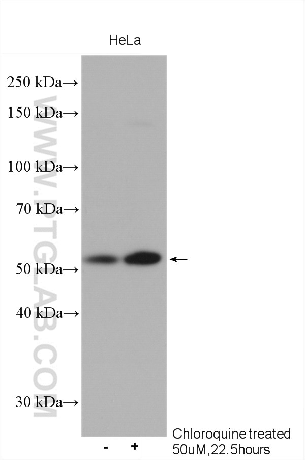 WB analysis using 10181-2-AP