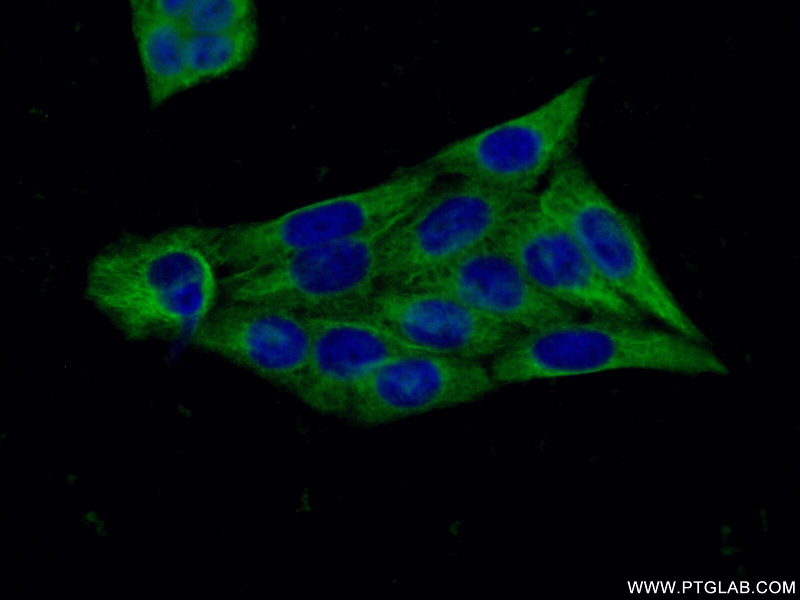 Immunofluorescence (IF) / fluorescent staining of HeLa cells using ATG5 Monoclonal antibody (60061-1-Ig)