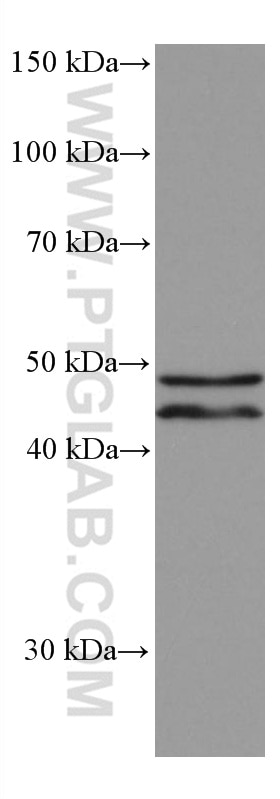 WB analysis of HeLa using 66744-1-Ig