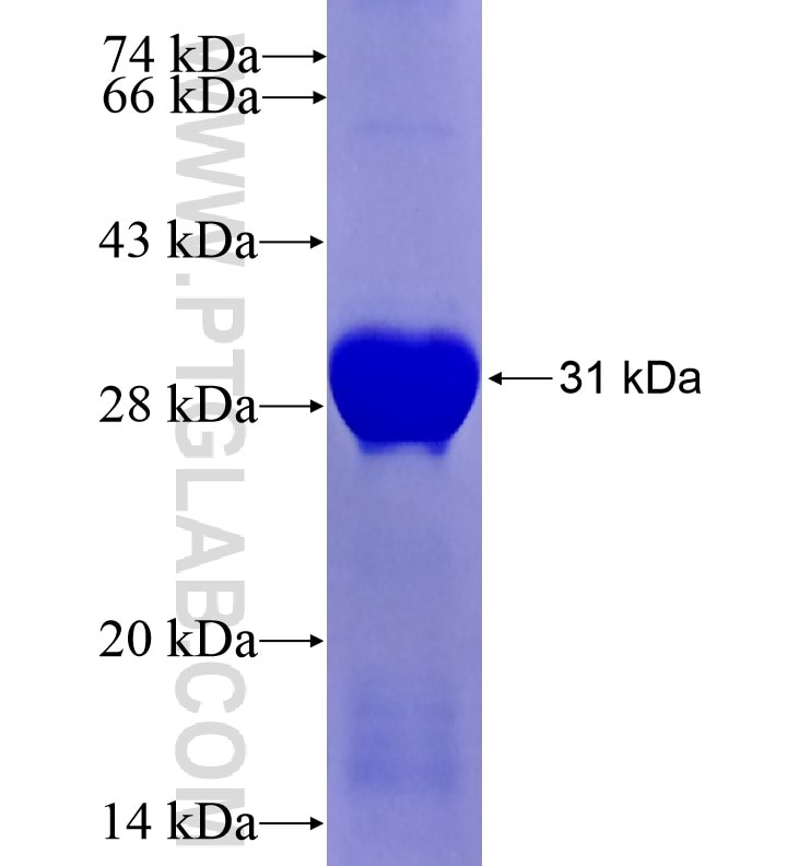 ATG5 fusion protein Ag16685 SDS-PAGE