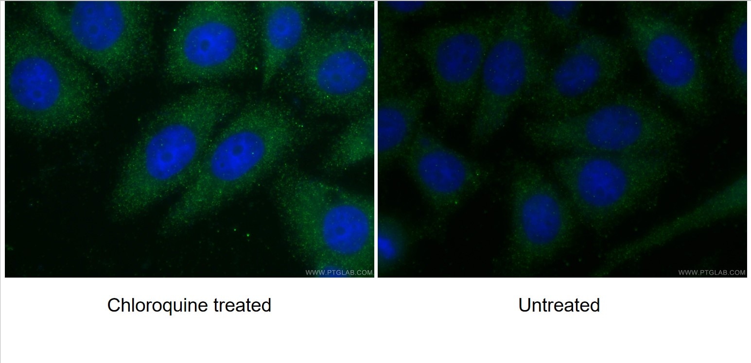 Immunofluorescence (IF) / fluorescent staining of HepG2 cells using ATG7 Polyclonal antibody (10088-2-AP)