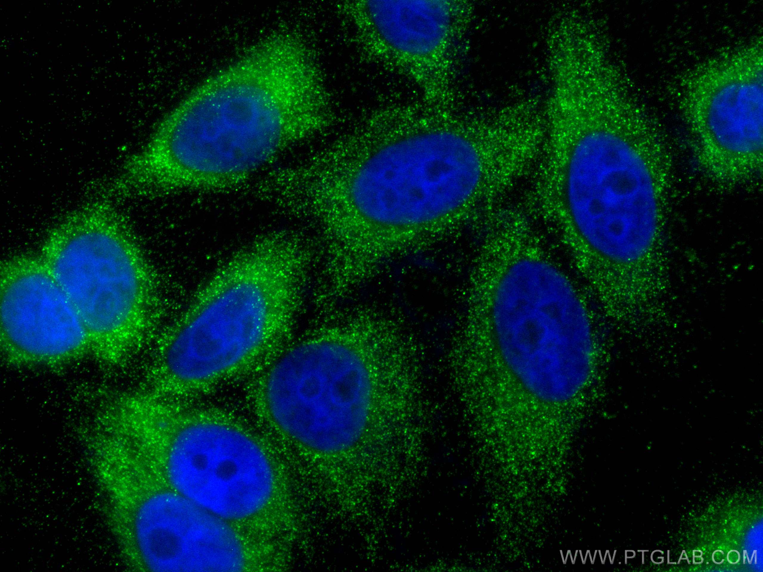 Immunofluorescence (IF) / fluorescent staining of HepG2 cells using ATG7 Polyclonal antibody (10088-2-AP)