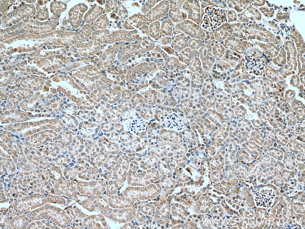 Immunohistochemistry (IHC) staining of mouse kidney tissue using ATG7 Polyclonal antibody (10088-2-AP)
