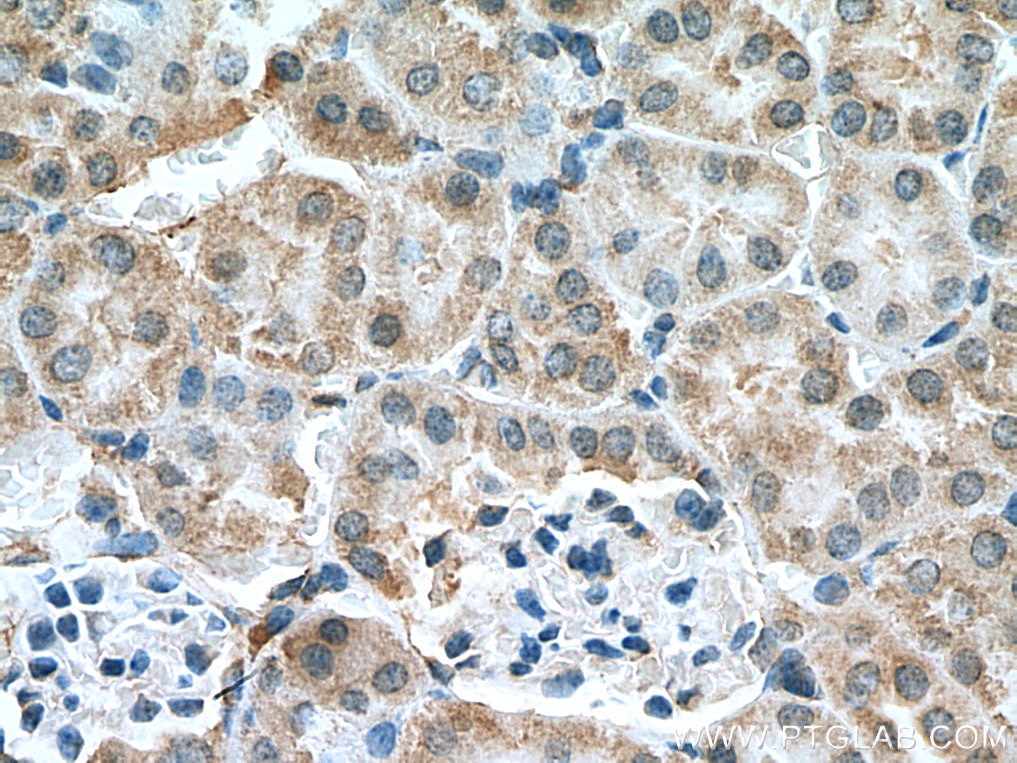 IHC staining of mouse kidney using 10088-2-AP