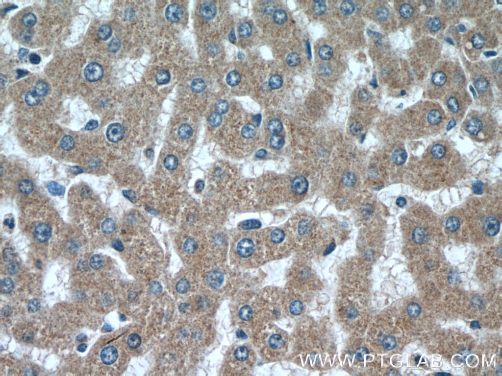 ATG7 Polyclonal antibody