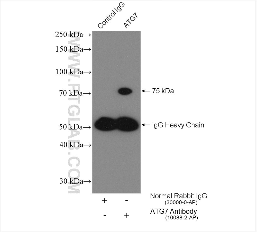 Immunoprecipitation (IP) experiment of HT-1080 cells using ATG7 Polyclonal antibody (10088-2-AP)