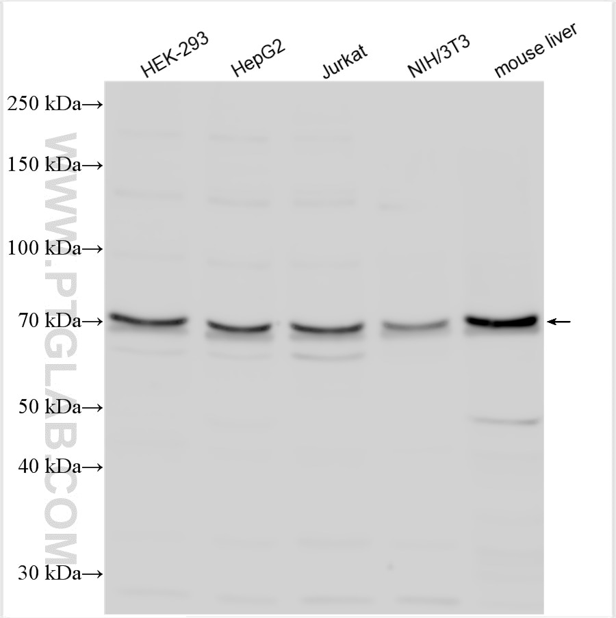 Western Blot (WB) analysis of various lysates using ATG7 Polyclonal antibody (10088-2-AP)