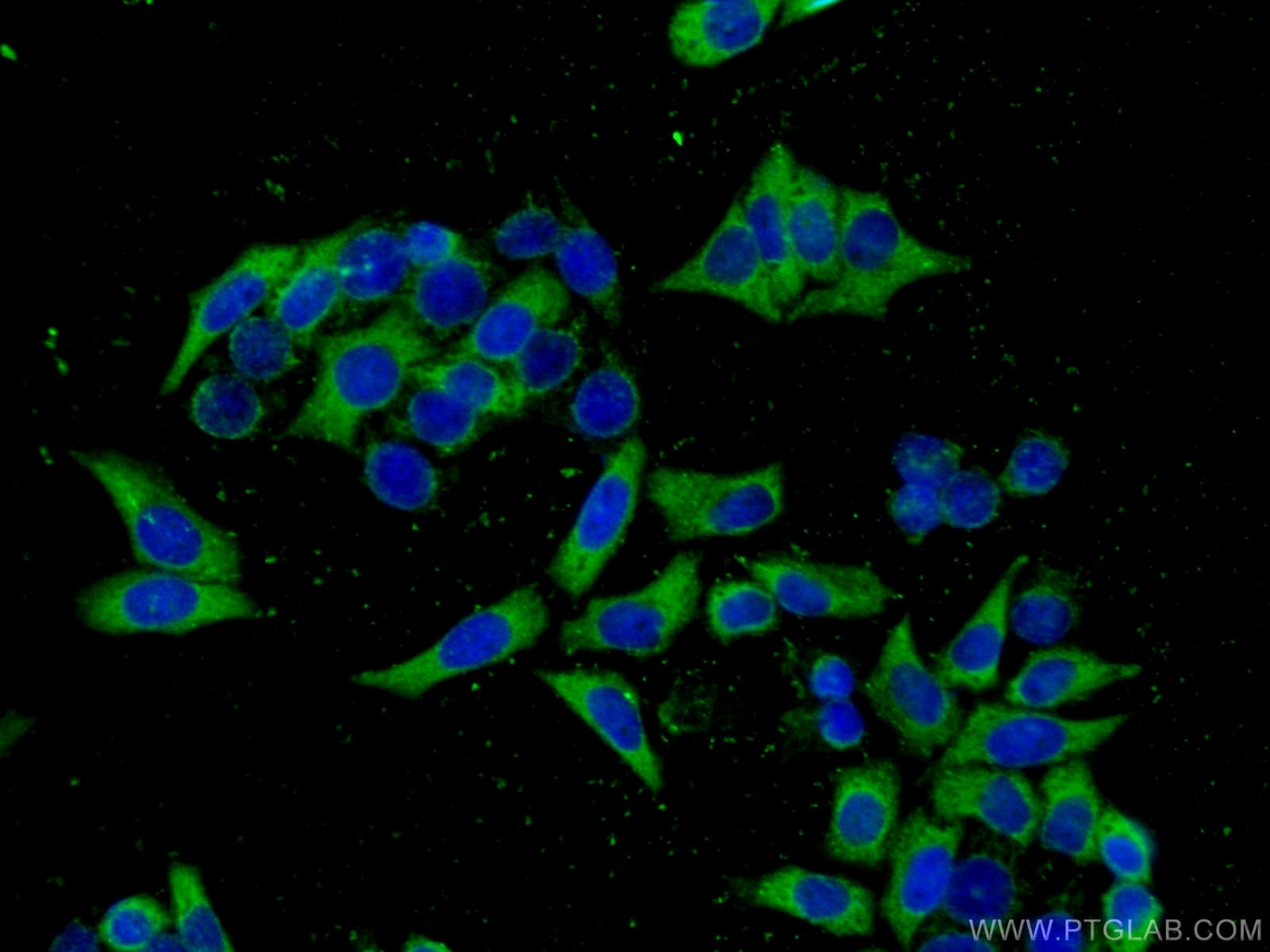 Immunofluorescence (IF) / fluorescent staining of HeLa cells using ATG7 Monoclonal antibody (67341-1-Ig)