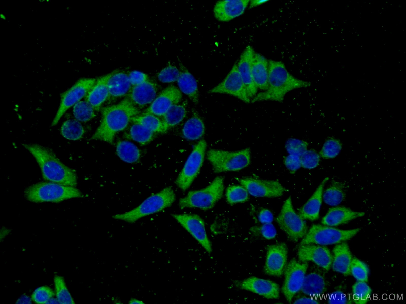 IF Staining of HeLa using 67341-1-Ig