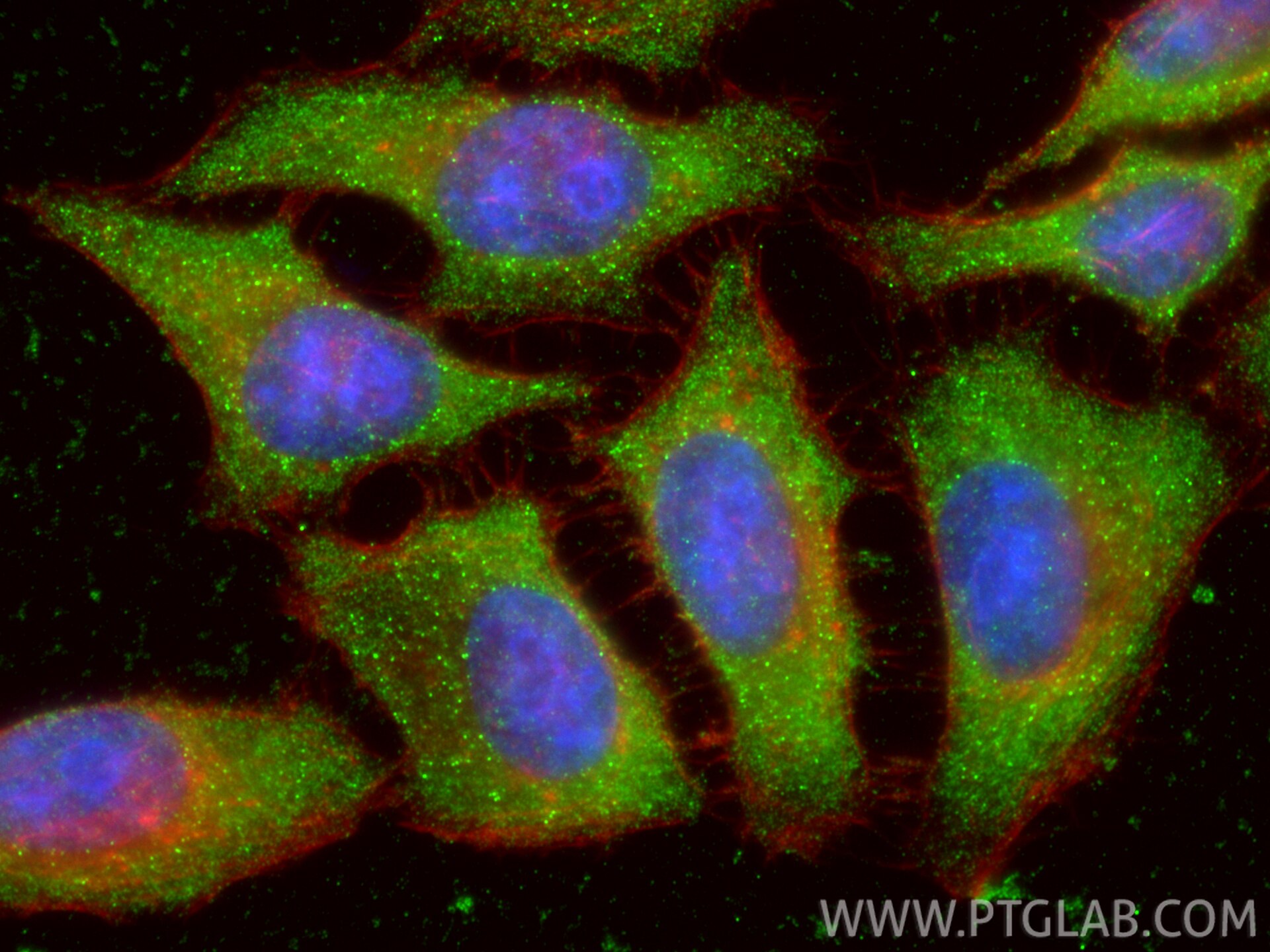 Immunofluorescence (IF) / fluorescent staining of HepG2 cells using ATG7 Monoclonal antibody (67341-1-Ig)