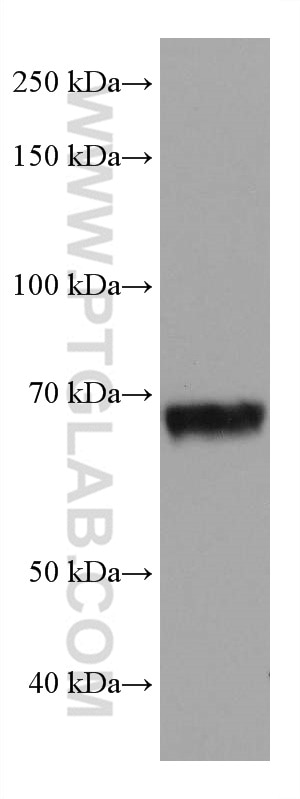 Western Blot (WB) analysis of 4T1 cells using ATG7 Monoclonal antibody (67341-1-Ig)