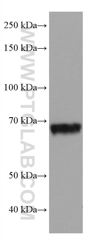 WB analysis of 4T1 using 67341-1-Ig