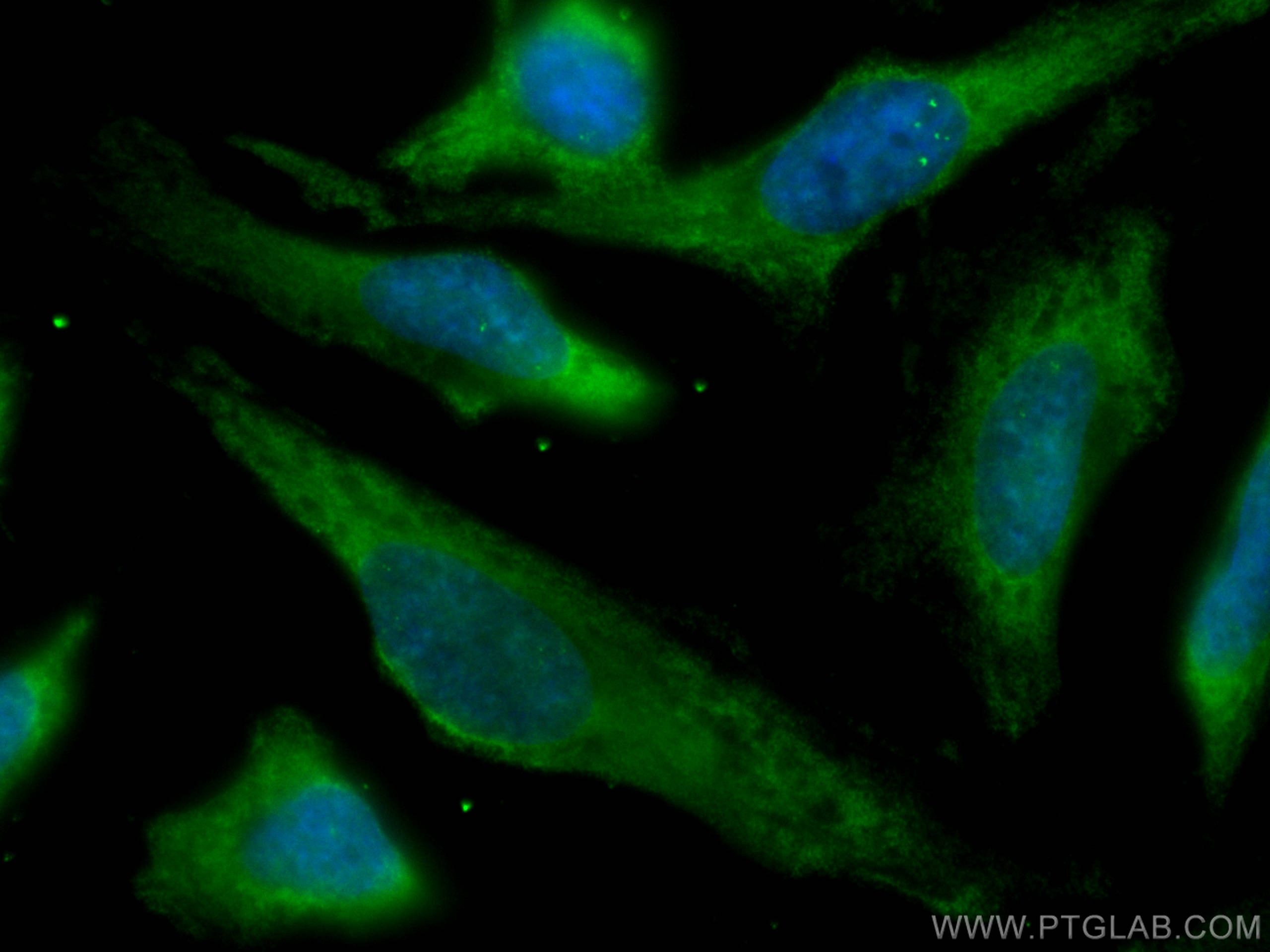 Immunofluorescence (IF) / fluorescent staining of HeLa cells using CoraLite® Plus 488-conjugated ATG7 Monoclonal anti (CL488-67341)