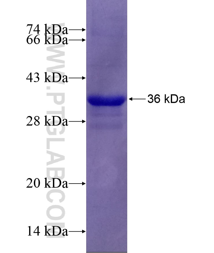 ATG7 fusion protein Ag27914 SDS-PAGE