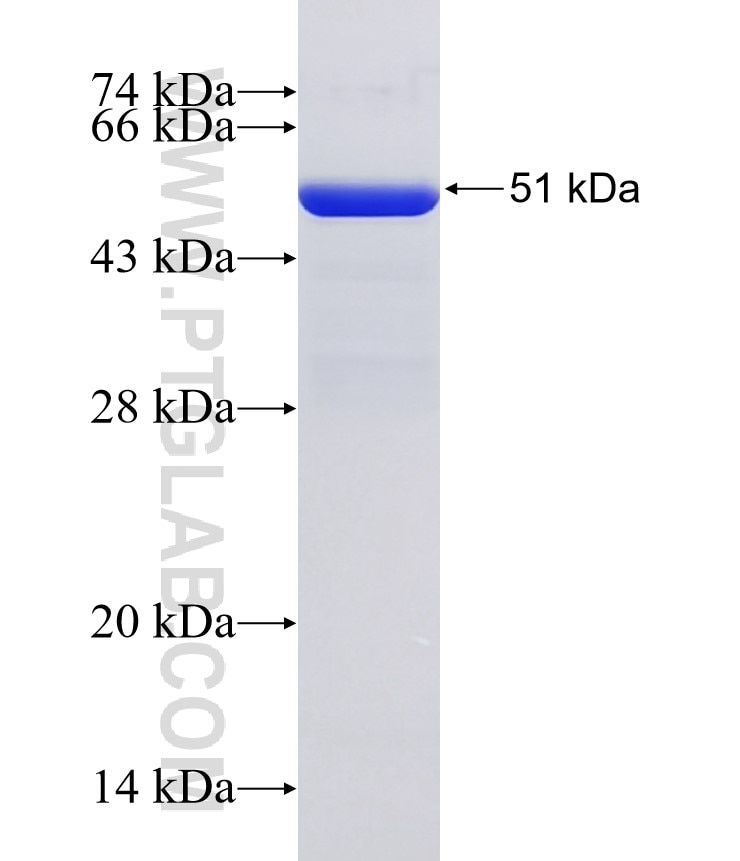 ATG7 fusion protein Ag29159 SDS-PAGE