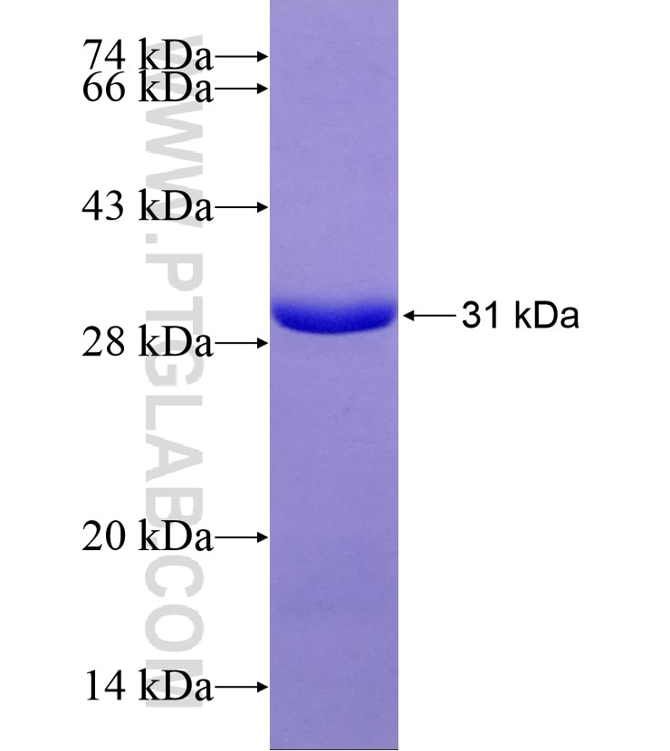 ATG7 fusion protein Ag29172 SDS-PAGE