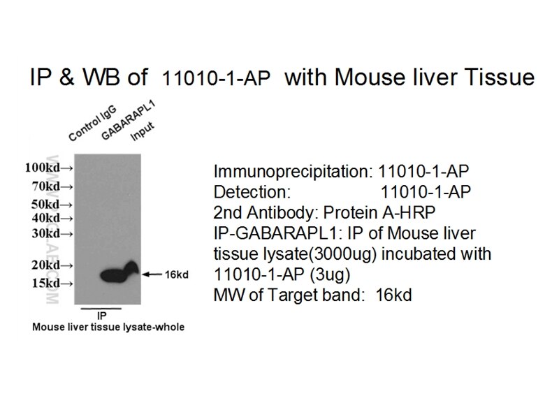 GABARAPL1