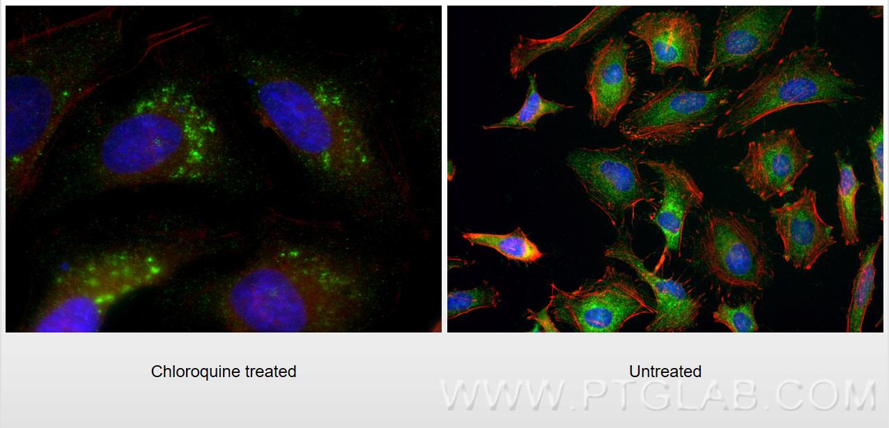Immunofluorescence (IF) / fluorescent staining of HeLa cells using GABARAPL1 Polyclonal antibody (11010-1-AP)