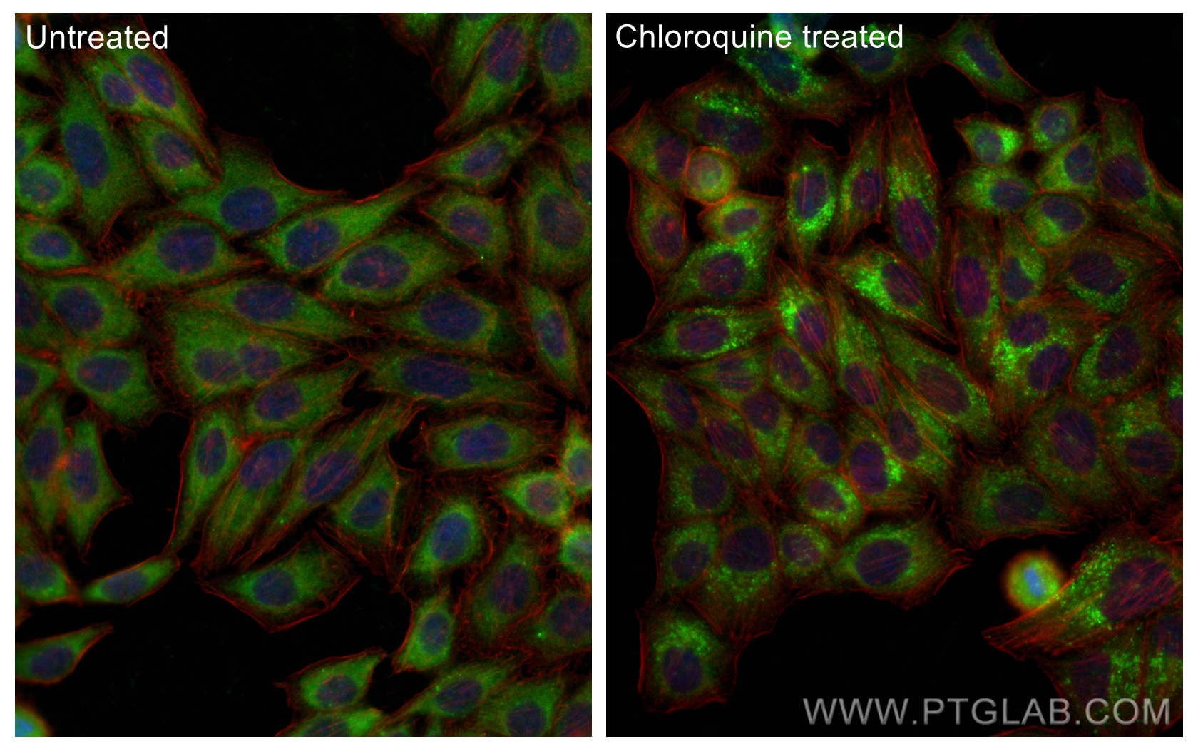 Immunofluorescence (IF) / fluorescent staining of HepG2 cells using GABARAPL1 Polyclonal antibody (11010-1-AP)